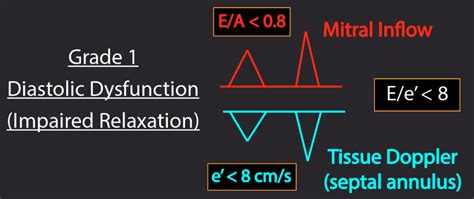 lvdd grade 1|ventricular diastolic dysfunction grade 1.